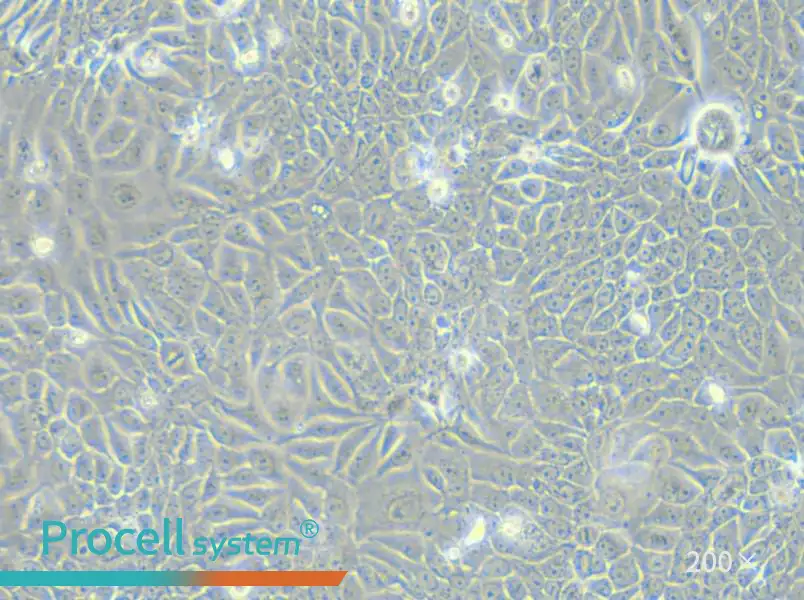 Eca-109 Cell Complete Medium - 6