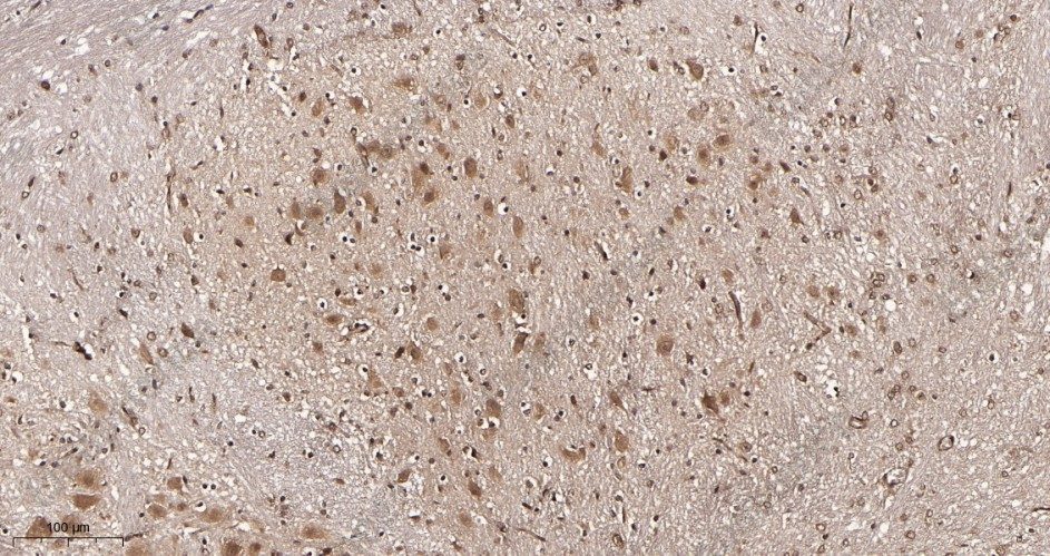 Recombinant Phospho-CDC37 (Ser13) Monoclonal Antibody - 3