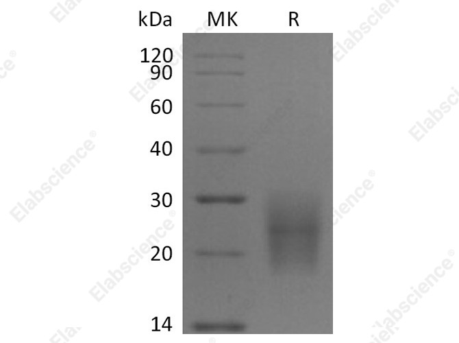 Recombinant Human CD3d/CD3 delta Protein (His Tag) - 1