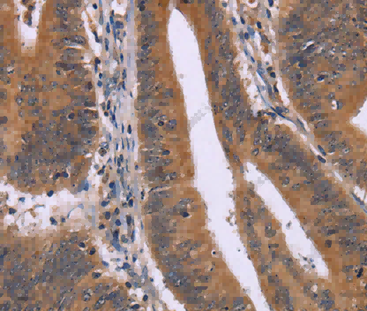 CMTM6 Polyclonal Antibody - 3