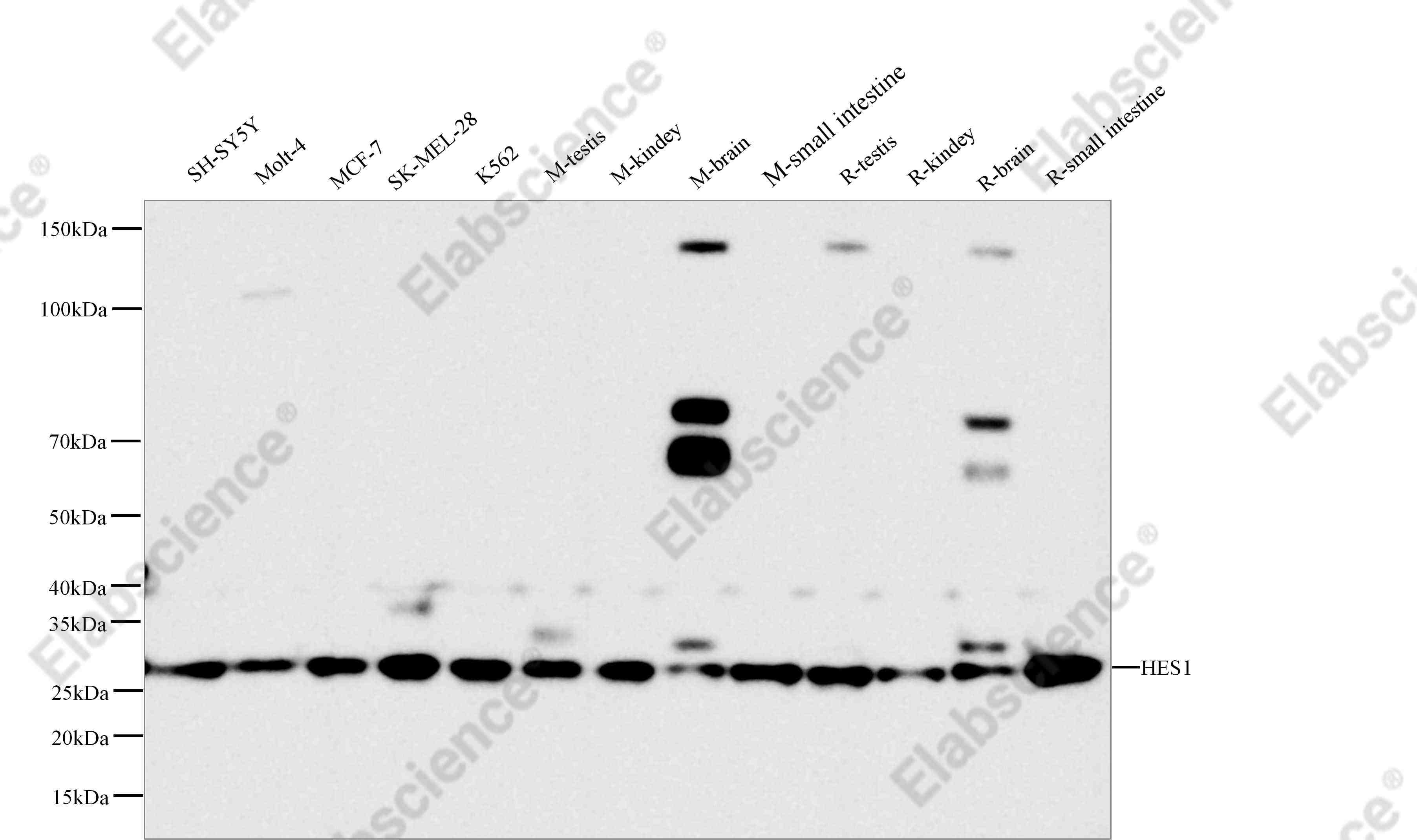Recombinant HES1 Monoclonal Antibody - 1