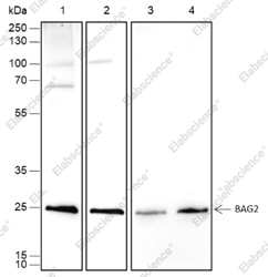 Recombinant BAG2 Monoclonal Antibody - 1