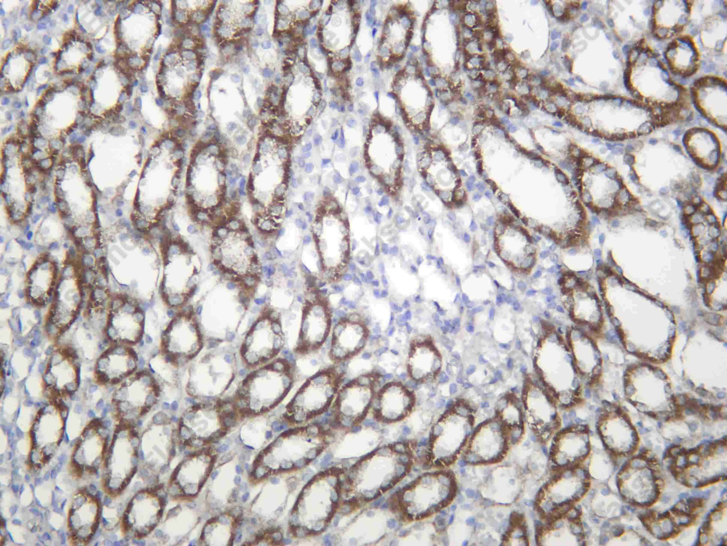 Recombinant CP27B Monoclonal Antibody - 3