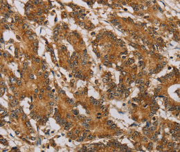 NDUFA10 Polyclonal Antibody - 2