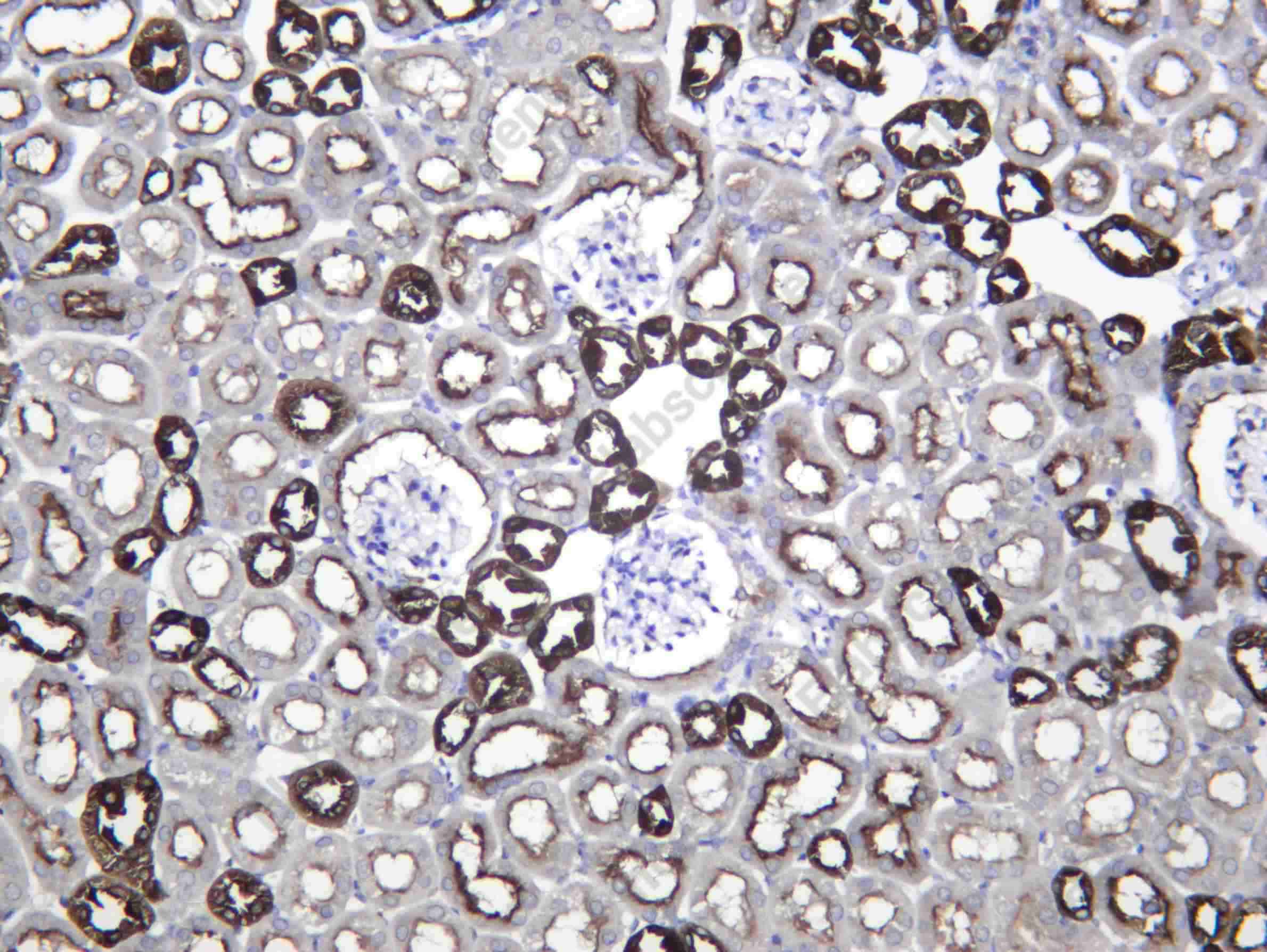 Recombinant V ATPase B1 Monoclonal Antibody - 2
