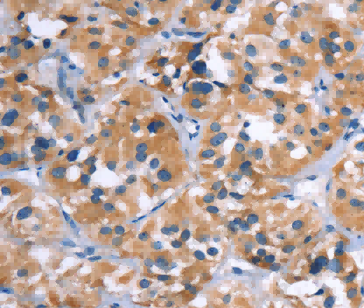 COMP Polyclonal Antibody - 2