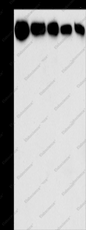 HK2 Polyclonal Antibody - 1