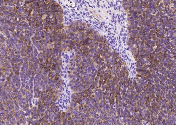 Mesothelin/MSLN Monoclonal Antibody - small - 1
