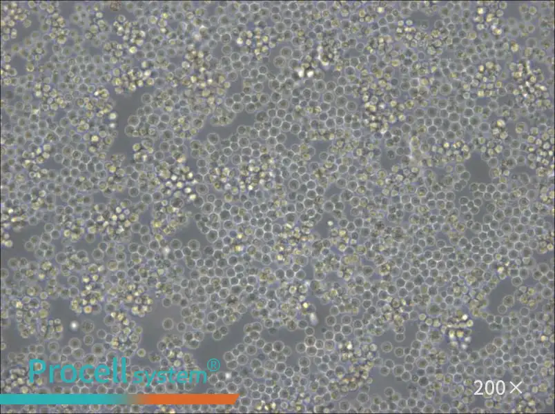 DoHH2 Cell Complete Medium - 5