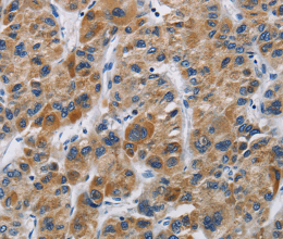 IFNGR2 Polyclonal Antibody - 2