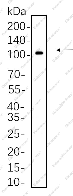 Recombinant Phospho-STAT5 (Tyr694) Monoclonal Antibody - 1