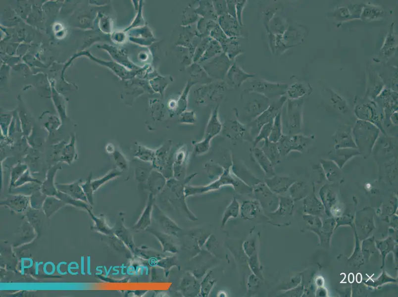 SK-OV-3 Cell Complete Medium - small - 4