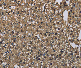 GSTA3 Polyclonal Antibody - 3