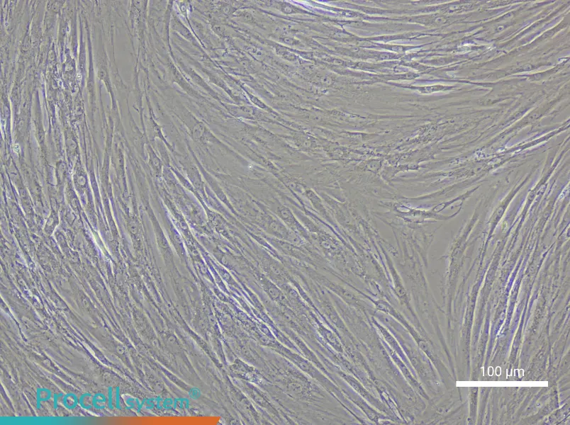 Human Glomerular Mesangial Cell Complete Medium - 2