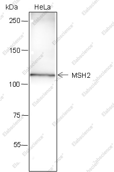 Recombinant MSH2 Monoclonal Antibody - 1