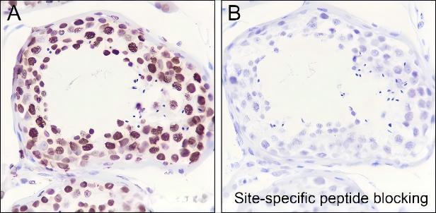 Recombinant Histone H3 (Acetyl Lys122) Monoclonal Antibody - small - 6