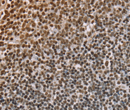 NUP50 Polyclonal Antibody - 2