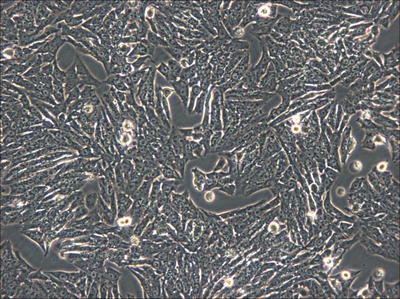 Y1 [Y-1] Cell Complete Medium - 4
