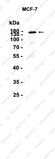 Recombinant DIAPH1 Monoclonal Antibody - 1