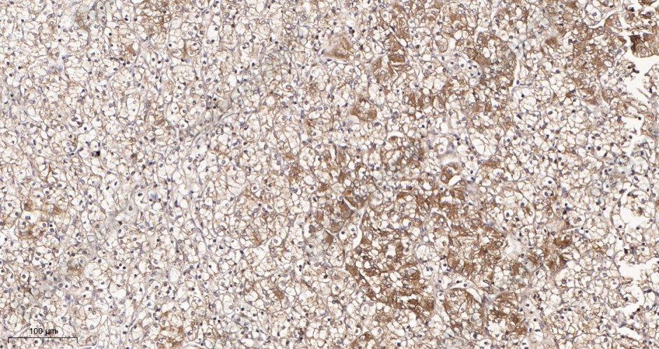 Recombinant N Cadherin Monoclonal Antibody - 2