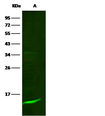 Recombinant B2M/beta-2 microglobulin Monoclonal Antibody - small - 2
