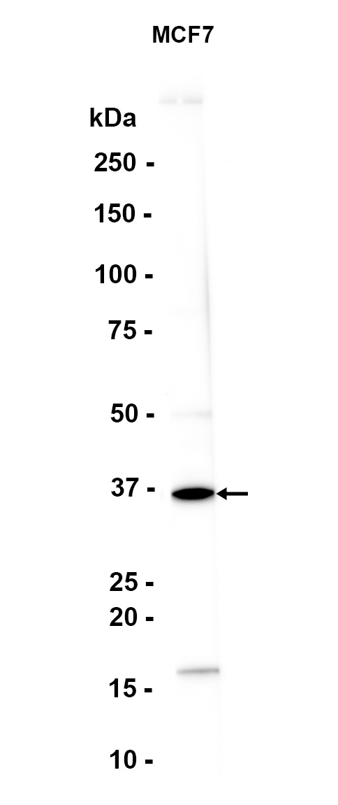 Recombinant RRM2B/P53R2 Monoclonal Antibody - 1