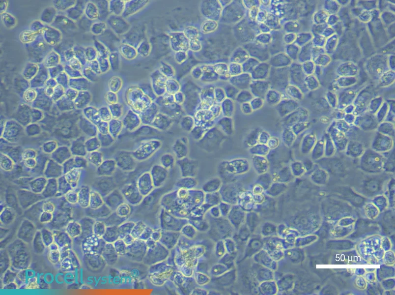 Mouse Nucleus Pulposus cells - 6