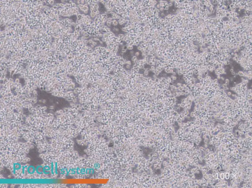 Hce-8693 Cell Complete MediumHce-8693 Cell Complete Medium - 3