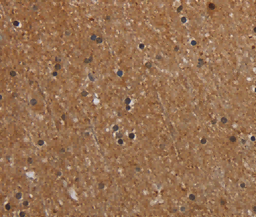 MT-ND1 Polyclonal Antibody - 3