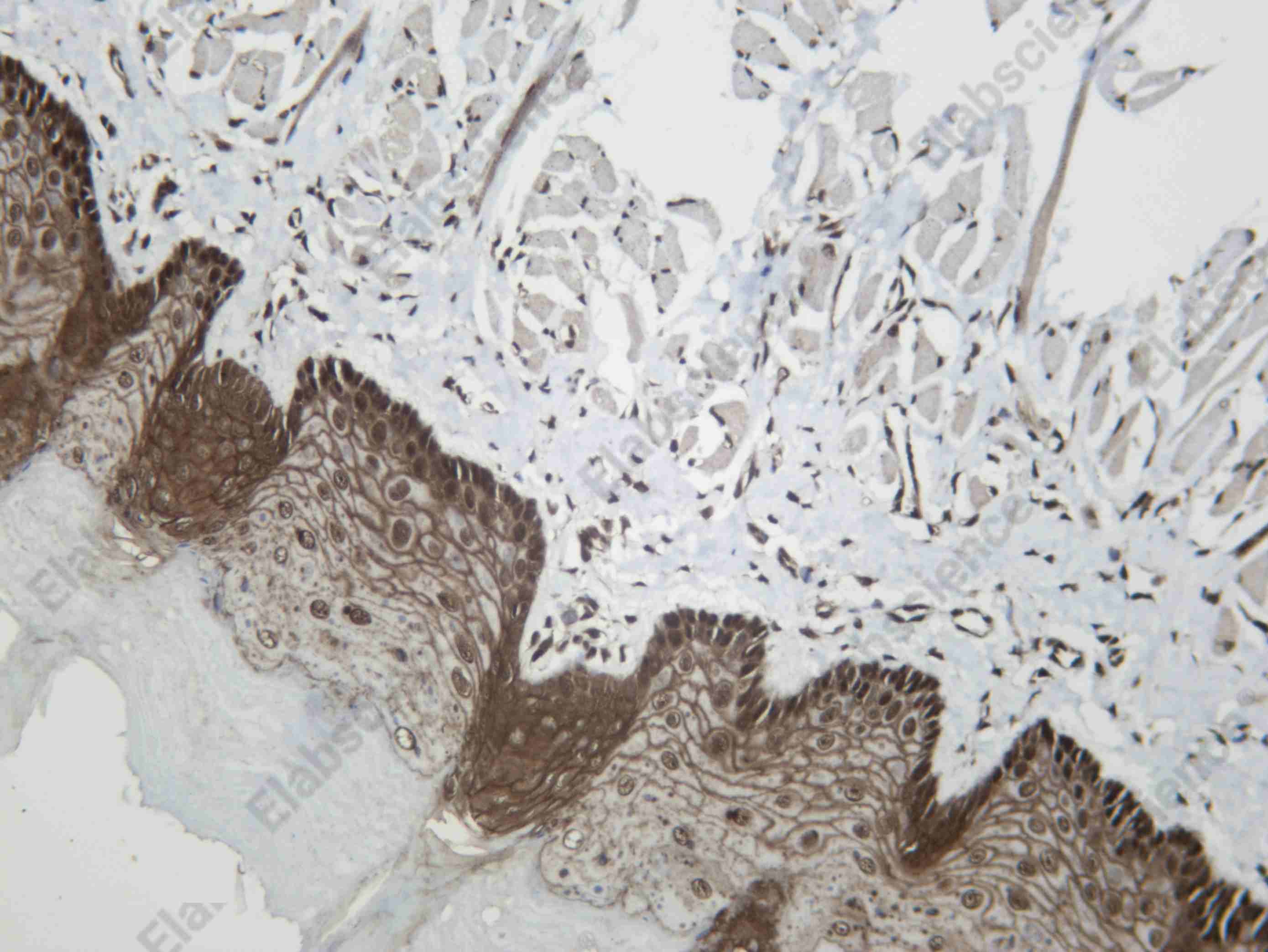 Recombinant DYL1 Monoclonal Antibody - 3