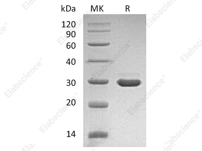 Recombinant Human β-NGF/NGFB Protein (with pro peptide) - 1