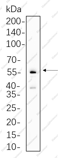 Recombinant Parkin Monoclonal Antibody - 1