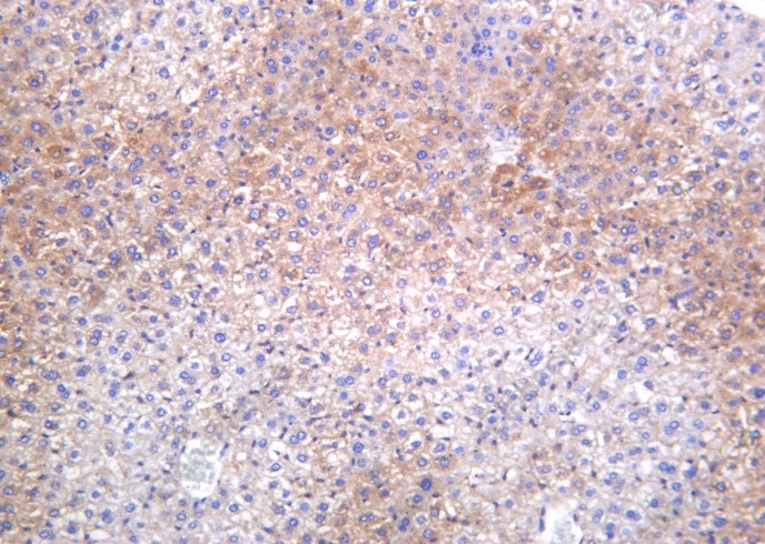 Recombinant Phospho-Acetyl-CoA Carboxylase (Ser79) Monoclonal Antibody - 2
