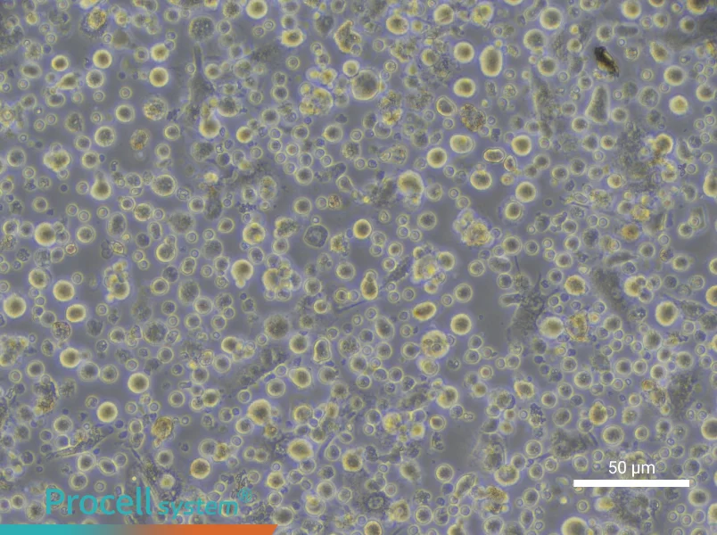 Human Mature Peripheral Blood Dendritic Cell Complete Medium - 4