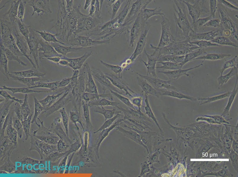 Rat Trabecular Meshwork Cell Complete Medium - 6