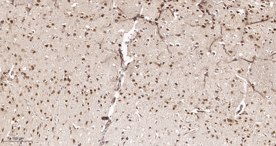 Recombinant TBR1 Monoclonal Antibody - small - 3