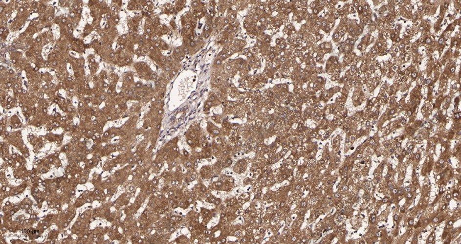 Recombinant GCLM Monoclonal Antibody - 2