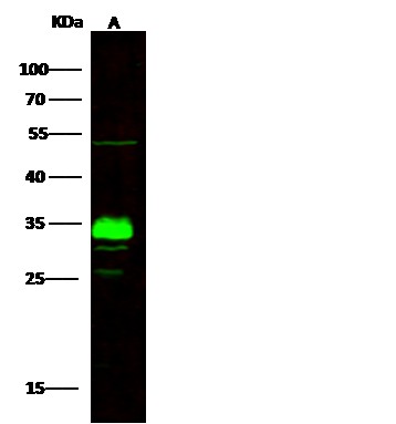 Recombinant ING5 Monoclonal Antibody - small - 2