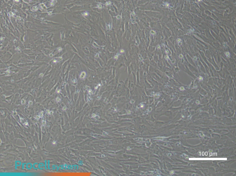Rat Bladder Fibroblast Complete Medium - 1