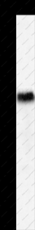 PGBD2 Polyclonal Antibody - 1