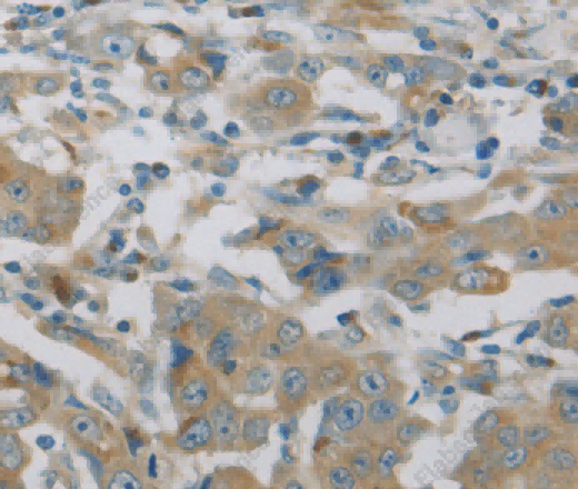 MAP2K6 Polyclonal Antibody - 3