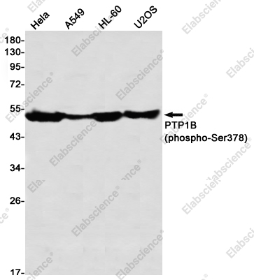 Recombinant Phospho-PTP1B (Ser378) Monoclonal Antibody - 1