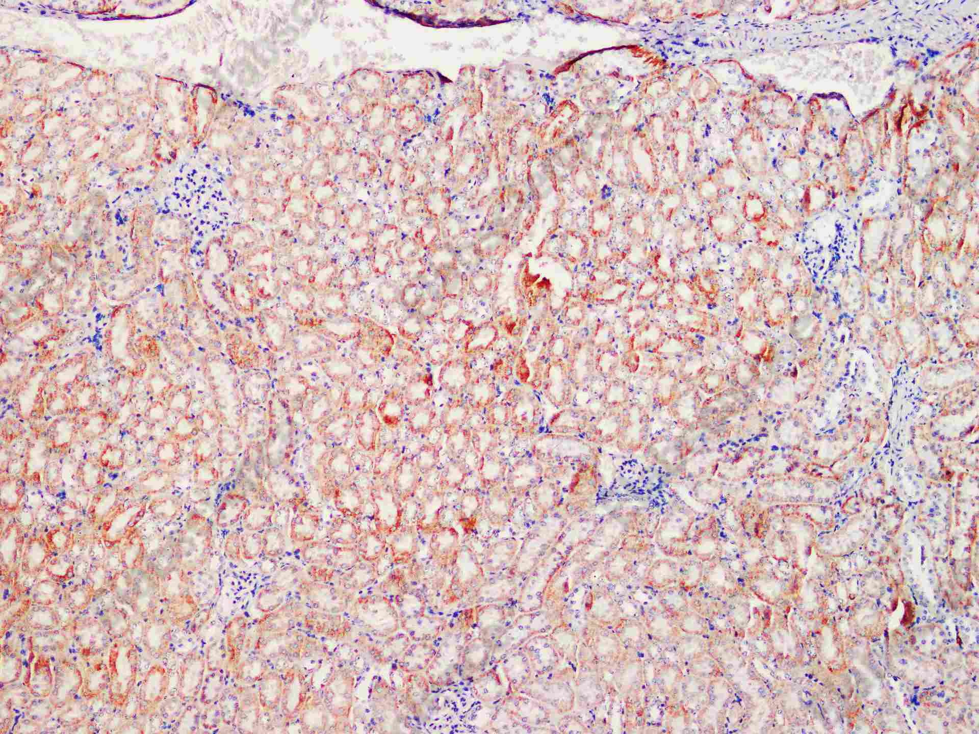 Recombinant SOD2 Monoclonal Antibody - 2