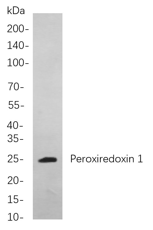 Recombinant Peroxiredoxin 1 Monoclonal Antibody-searchlist-1