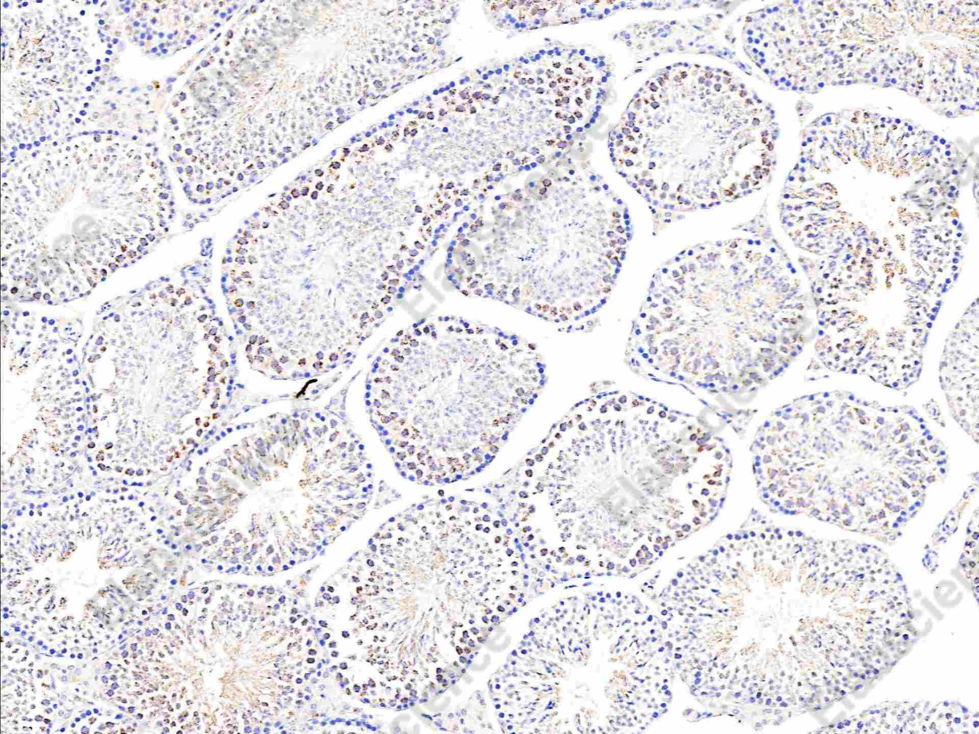 Recombinant SMAC/Diablo Monoclonal Antibody - 1