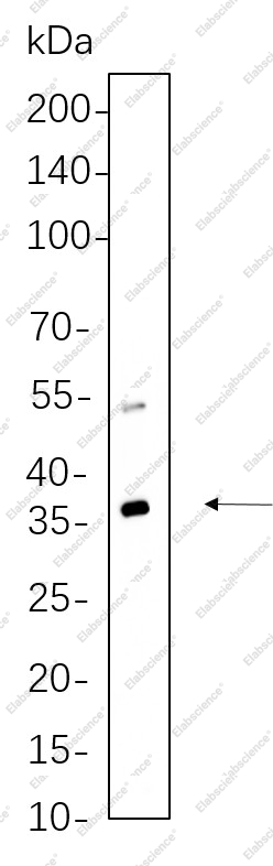 Recombinant ATG3 Monoclonal Antibody - 1