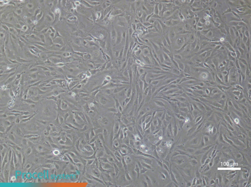 Human Lymphatic Endothelial (Primary cell immortalization) Cell Complete Medium - 2