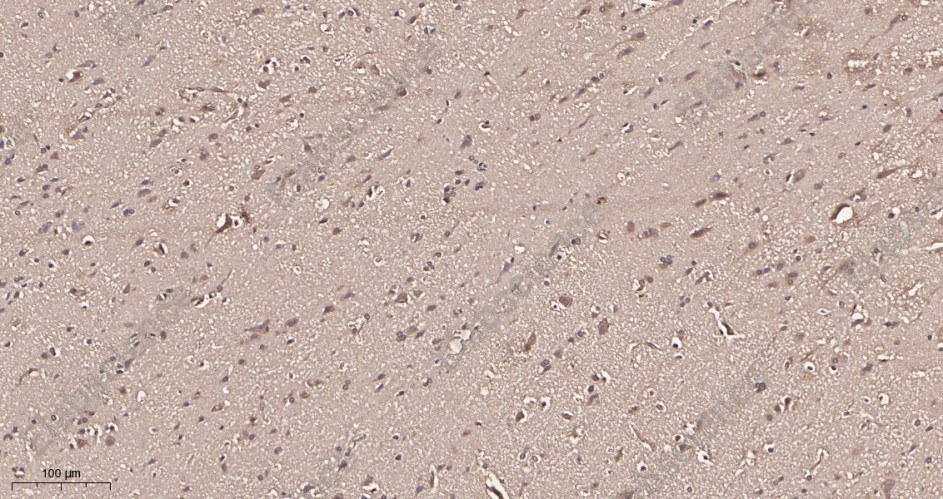 Recombinant Phospho-CDC37 (Ser13) Monoclonal Antibody - 2