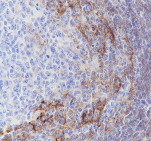 Recombinant CD23 Monoclonal Antibody - small - 2
