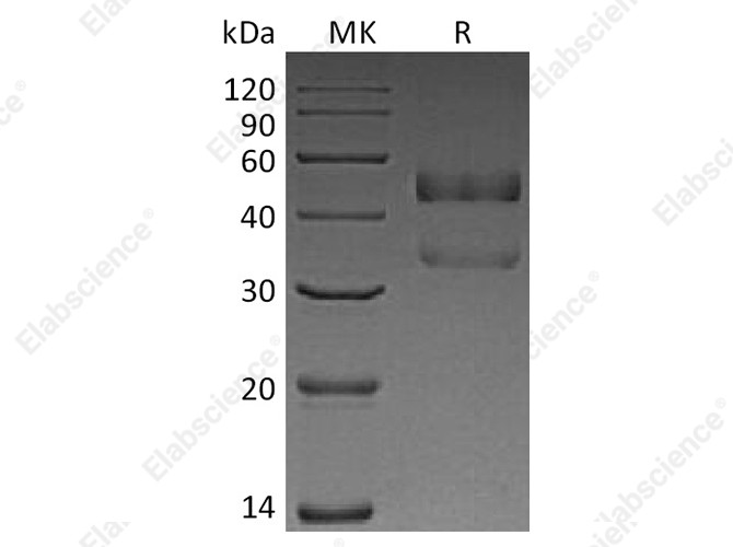 Recombinant Human ANGPTL7 Protein (His Tag) - 1